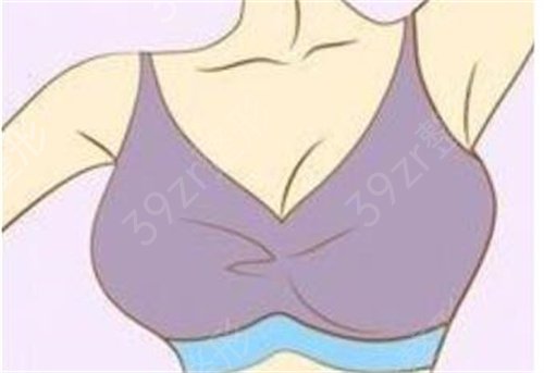 *隆胸一种不用开动就可以变大胸的手术方式