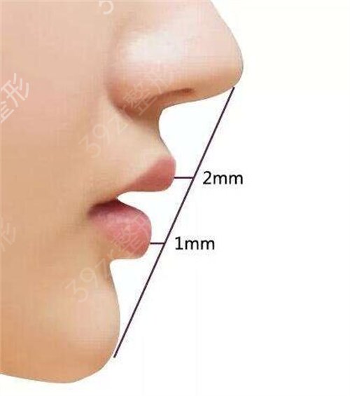 鼻孔缩小手术图，鼻孔缩小这两种方法*