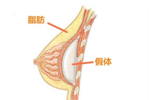上海九院隆胸专家名单，相关案例及预约通道开启！