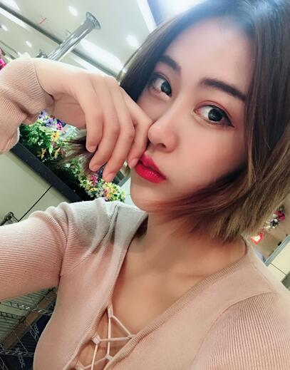 膨体柳叶综合鼻术后恢复果历程分享！