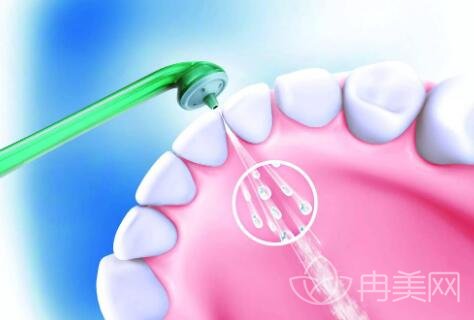 洗牙的作用是什么?洗牙的利与弊，洗牙能美白牙齿吗?