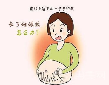 橄榄油去妊娠纹是真的吗?在孕期就要开始抹吗?