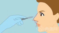 膨体隆鼻能保持终生吗?一般能保持多少年?