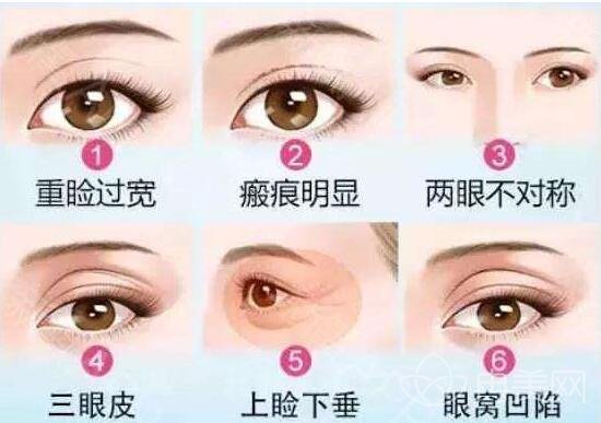 南京双眼皮整形医院比较好的有哪些?