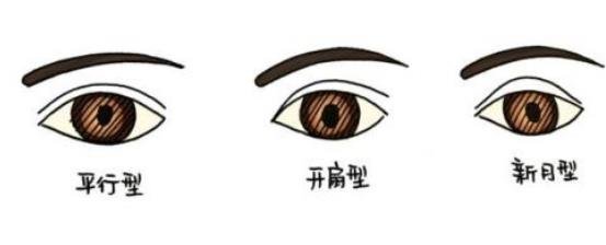 开外眼角