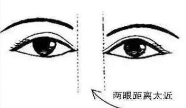开外眼角