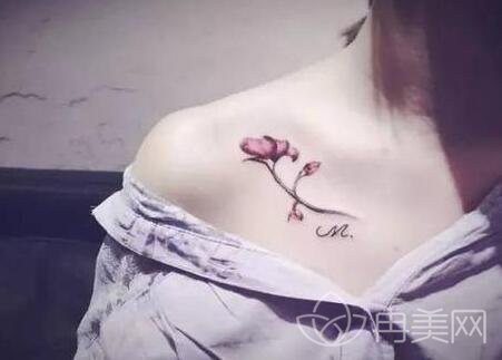 激光去纹身为什么需要多次调节?会留疤吗?