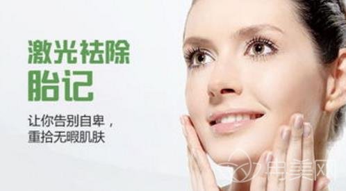 胎记影响美观，激光去胎记确定不安排一下吗？