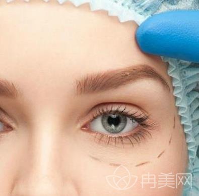 胎记影响美观，激光去胎记确定不安排一下吗？