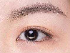 2021双眼皮！双眼皮有什么好处?双眼皮手术成功的标准是什么?