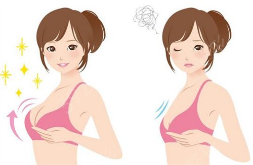 北华大学附属医院整形美容科隆胸案例