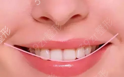 武汉大学口腔医院整形美容科牙齿美白案例