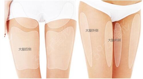 郑州大学第三附属医院（河南省妇幼保健院）整形美容科腿部吸脂案例