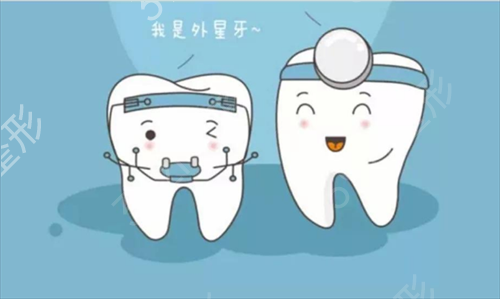 上海摩尔口腔门诊部牙齿美白贴片案例