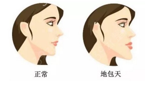 上海科发源医疗美容门诊部种发际线案例