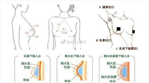 吉林中西医结合医院隆鼻