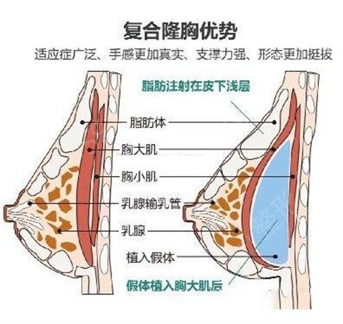 吉林中西医结合医院面部吸脂案例