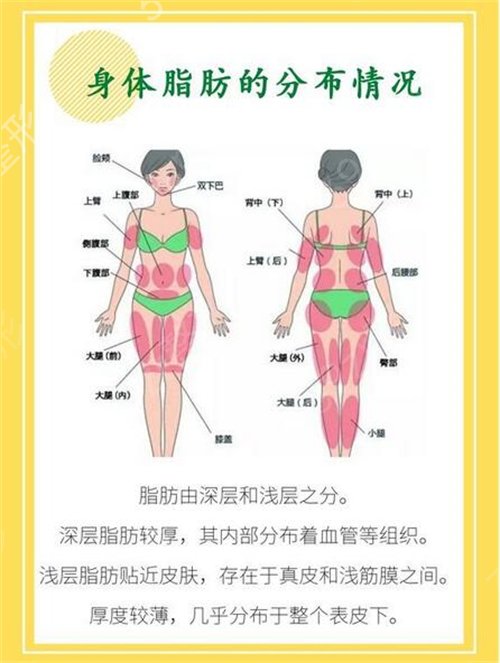 郑州市第三人民医院整形美容科大腿吸脂案例