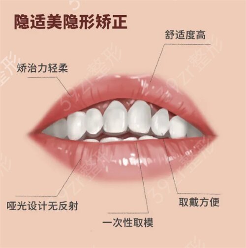 北京中诺口腔医院半隐形牙齿矫正案例