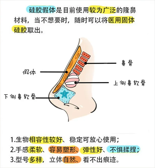 中国人民解放军第三中心医院整形外科假体隆鼻案例：