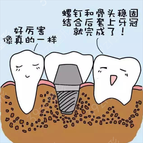 天津市公安医院口腔科种植牙案例