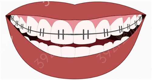洛阳市第三人民医院口腔科价格表，附牙齿矫正案例
