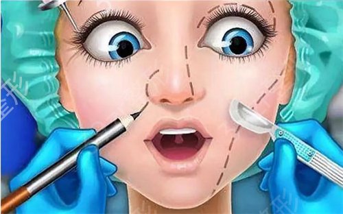 【医院隆鼻日记】去长沙脸博士做了硅胶隆鼻，给你们分享下过程和*果