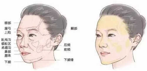 一直想整网红脸，去北京联合丽格找陈万芳做了3D脂肪面部*术后俩月*果