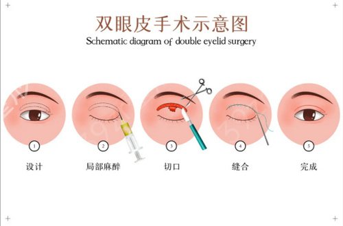 邢新整形医生