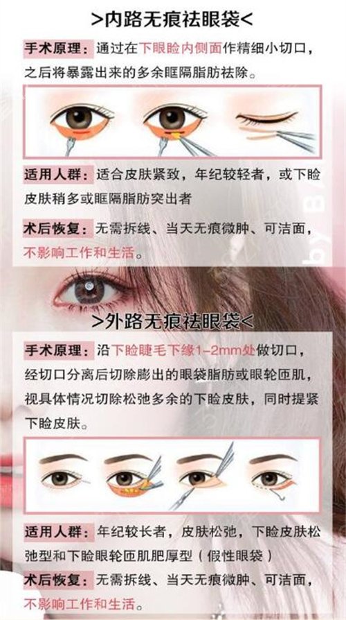 武汉第一医院美容科祛眼袋怎么样?过程实拍图|科室简介|医生介绍