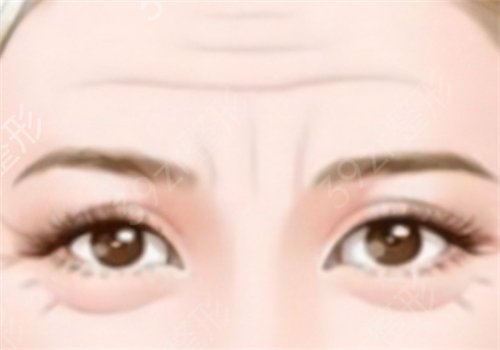 如何减少眼角皱纹?冉美网告诉你减少眼角皱纹的方法!