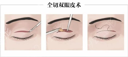 广东韩妃李光琴