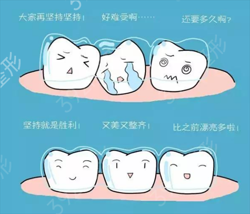 广州致美口腔医院钢丝牙套矫正手术，让我收获了自信微笑