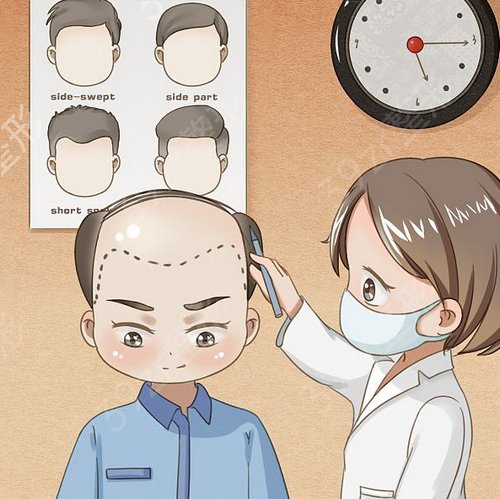 北京空军总医院整形美容科植发怎么样？术后*果实拍图