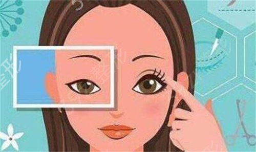 陕西省人民医院割双眼皮怎么样?割双眼皮经历及2020整形价格表一览
