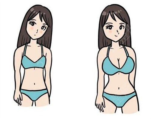 江苏省人民医院整形科门诊时间表及自体脂肪丰胸前后图一览
