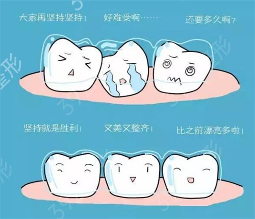重庆美维口腔医院案例图集，牙齿拥挤矫正畅快分享！