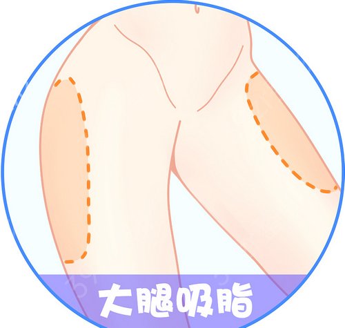 上海艺星吸脂怎么样?小姐姐分享如何拥有一双筷子腿 