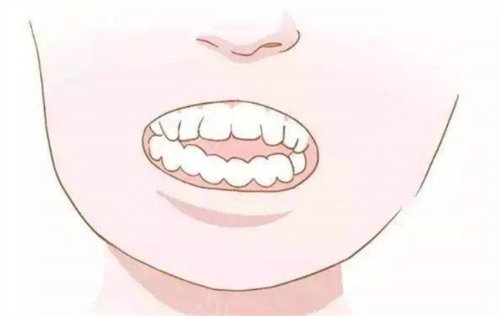 记录徐悠游医生做牙齿矫正后的两个月*果