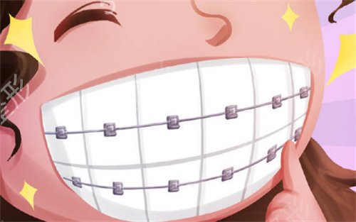记录徐悠游医生做牙齿矫正后的两个月*果