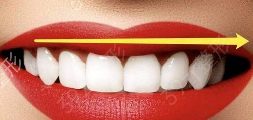重庆医科大学附属口腔医院整形科价目表火热上线,附牙齿矫正案例