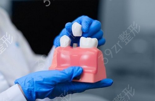 上海拜尔口腔门诊部整形价格表更新，附种植牙案例展示