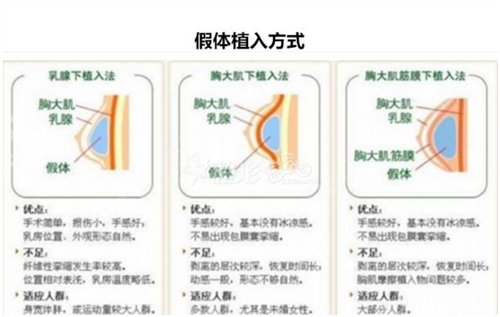 湖南省肿瘤医院整形外科假体隆胸