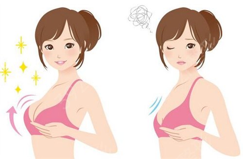 天津医院整形科乳房下垂矫正