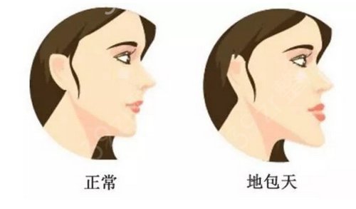 青医附院整形美容科植发好吗?2020年价格表及植发真人案例一览