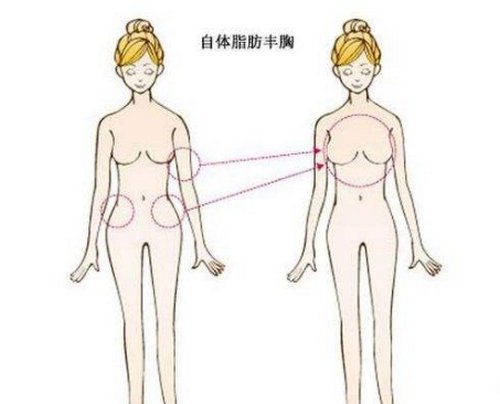 2020年第四军医大学西京医院整形科价格表及脂肪隆胸*果反馈图