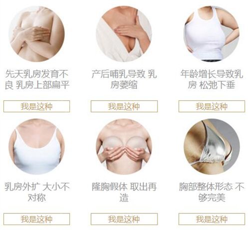 北京朝阳医院整形外科隆胸多少钱?价格表和真人案例一览