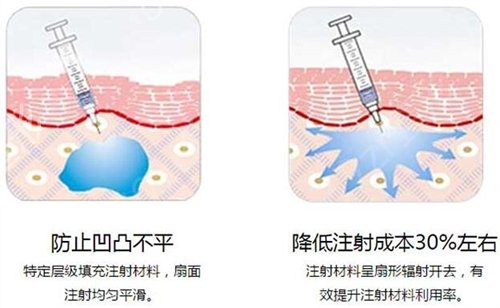 遂宁市中心医院美容科做嘴唇怎么样?请欣赏医院丰唇案例展示