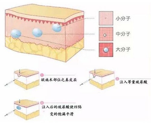 遂宁市中心医院美容科做嘴唇怎么样?请欣赏医院丰唇案例展示