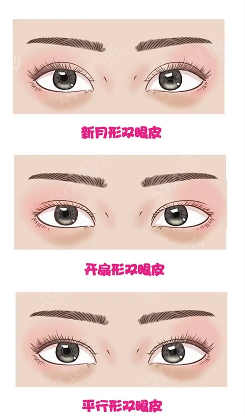 武汉奥黛丽医院价格表全新一览，附双眼皮术后反馈